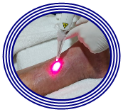 Laserterapia